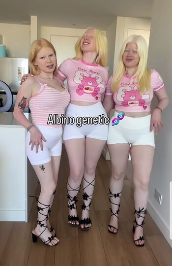 Full leaked Albino models private onlyfans photo