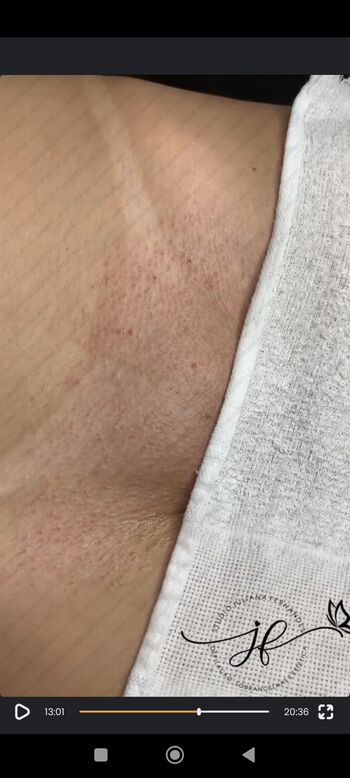 Full leaked Bronzeamento natural page private onlyfans photo