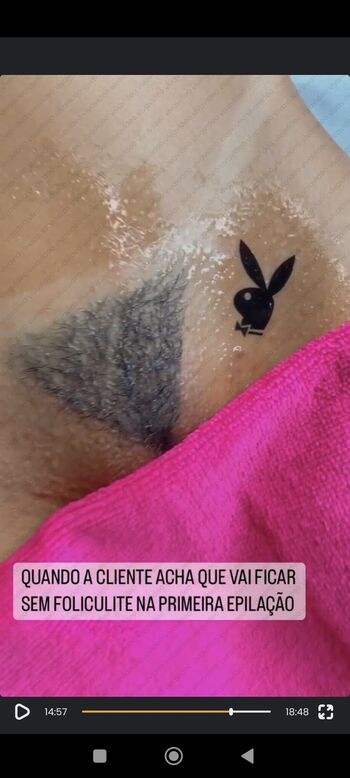 Bronzeamento Natural