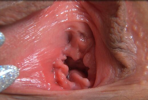 Full leaked Tripforfuck private onlyfans photo