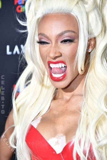 Full leaked Winnie harlow page private onlyfans photo