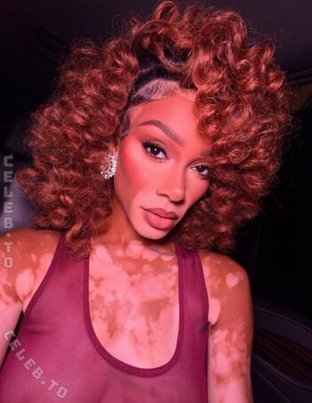 Full leaked Winnie harlow page private onlyfans photo