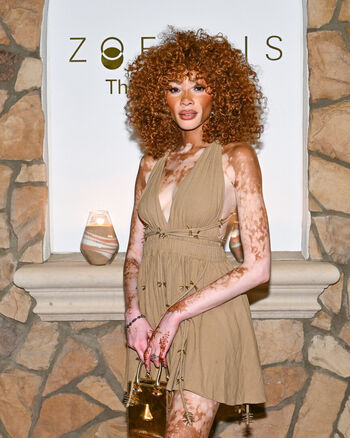 Full leaked Winnie harlow private onlyfans photo